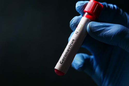 Latest company news about SARS-CoV-2 চক্রের থ্রেশহোল্ড: একটি মেট্রিক যা গুরুত্বপূর্ণ (বা না)